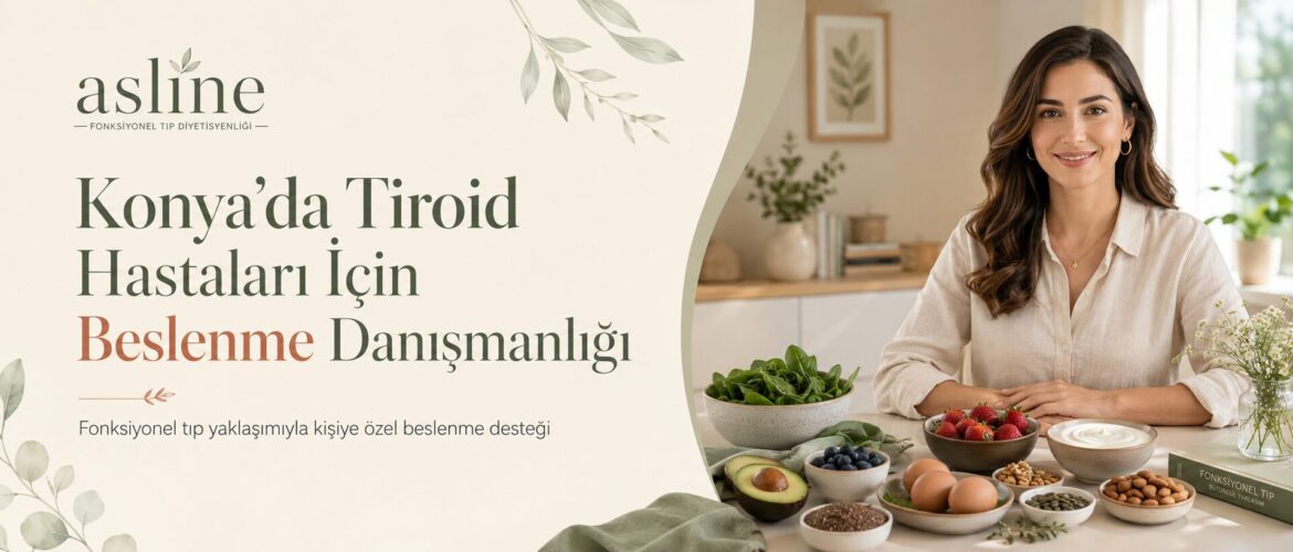 troid